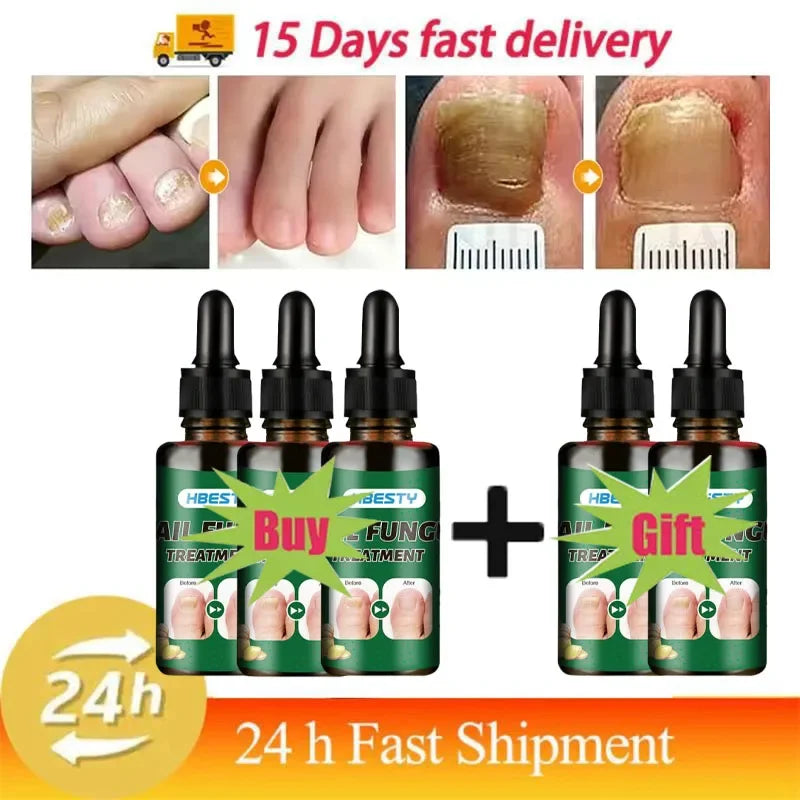 Nail Repairing Liquid Essence Hand Care Foot Fungal Removal Repair Serum Anti-infective Paronychia Nail Polish Repair Products