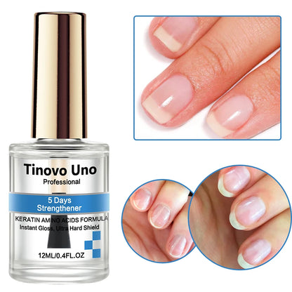 Tinovo Uno 5 Days Nail Strengthener Keratin Bio Formula Nail Care Products Lacquer Top Coat Natural Dry Enamel Repair Manicure