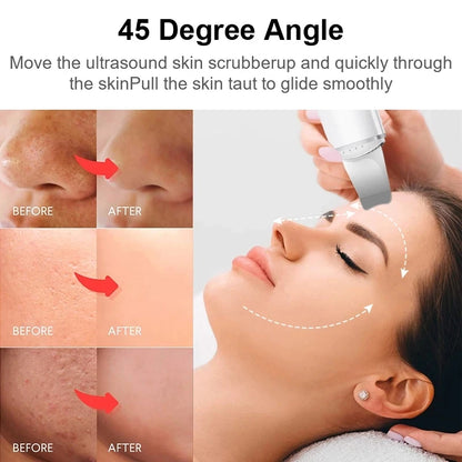 Xiaomi Ultrasonic Skin Scrubber Vibration Face Spatula Blackhead Remover Shovel Clean Cavitation Peeling Facial Lifting YOUPIN