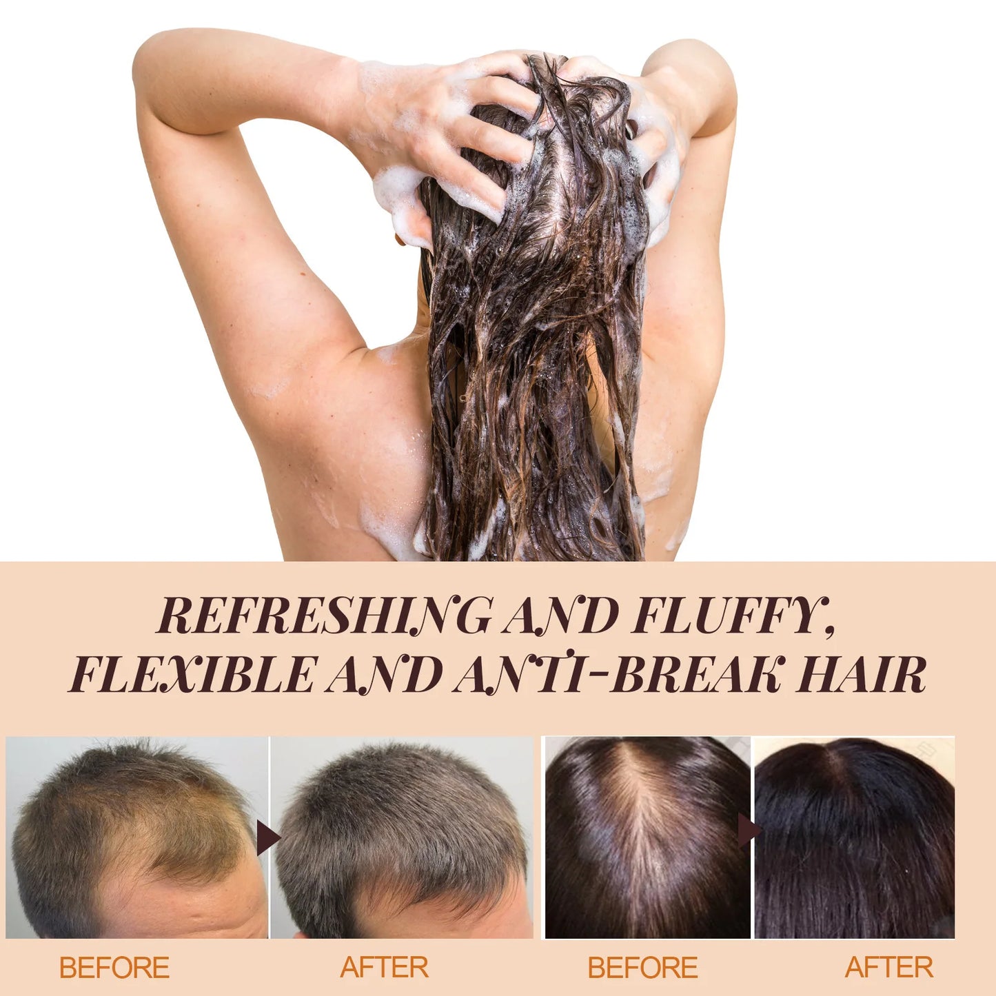Hair Loss Treatment Fast Hair Growth Hair Anti Thinning Repair Scalp Strengthen Hair Roots Deep Cleansing Thickening Hair Care