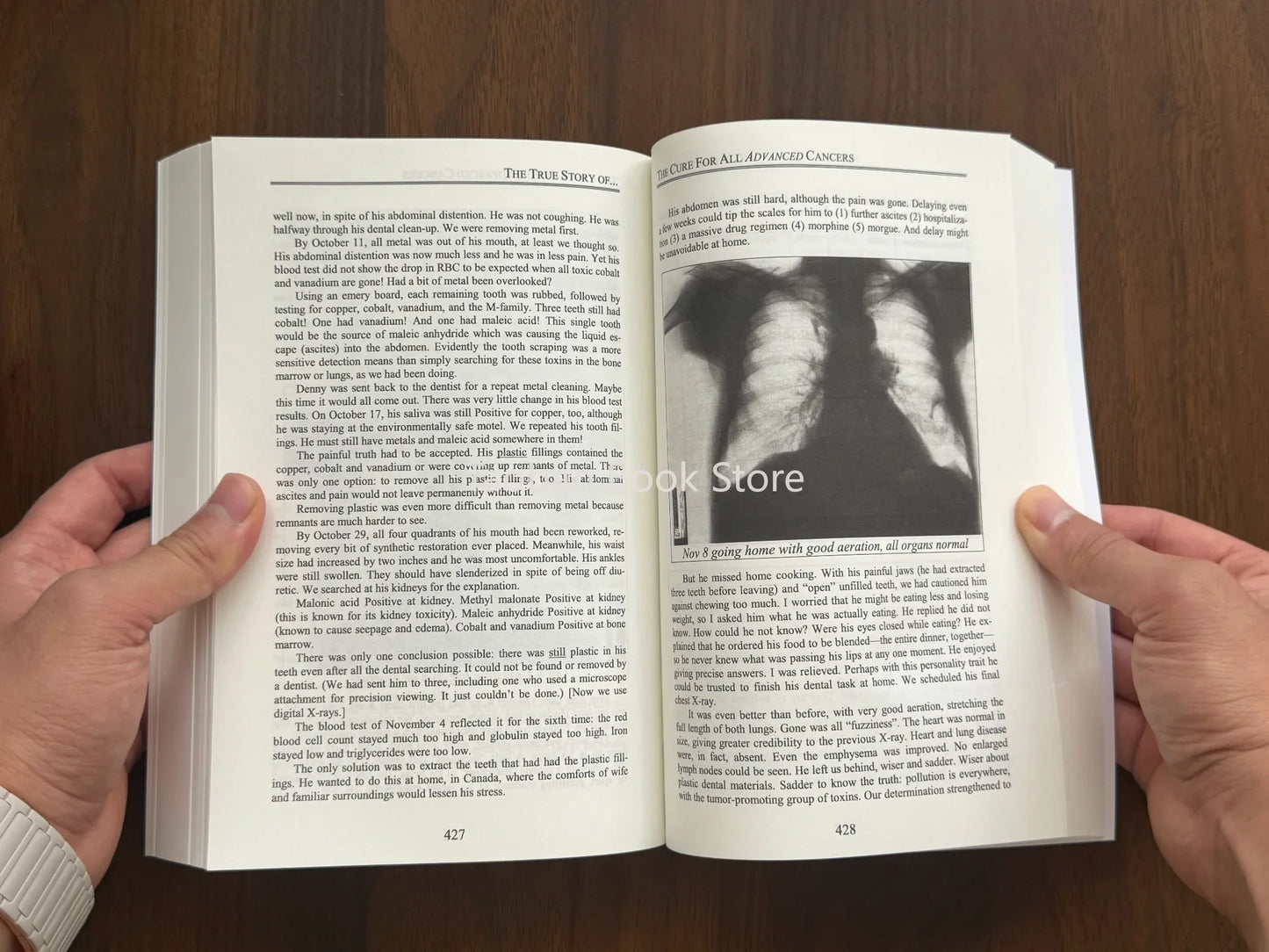 The Cure for All Advanced Cancers Book By Dr. Hulda Clark | Tumor Treatment Natural Therapy Guide  Libros