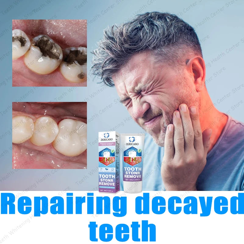 Healthy Teeth Remove Cavity Probiotics, 99% Repurchase