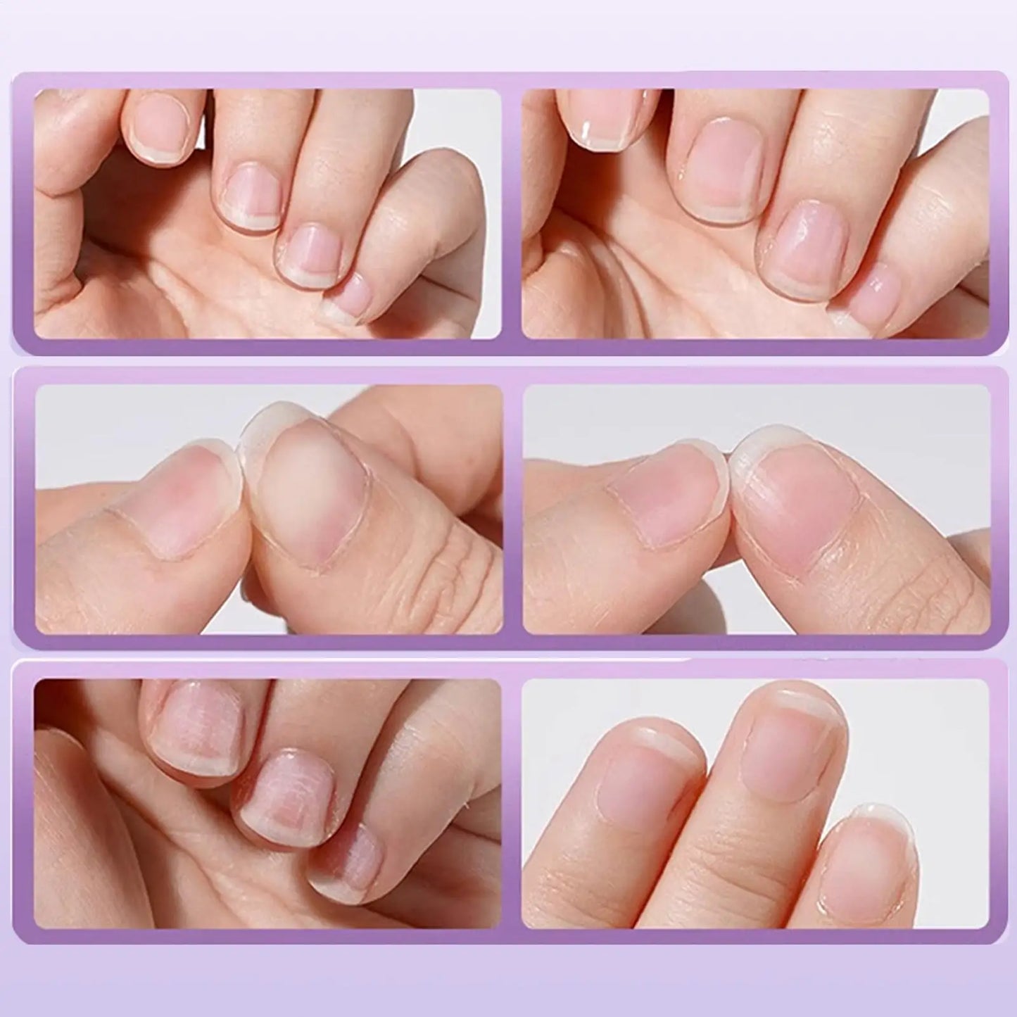 Nail Strengthener Damaged Nail Care Chip-resistant Cuticle Remover Pen for Nourishing Split Cracked Youth Weak Thin Men Elderly