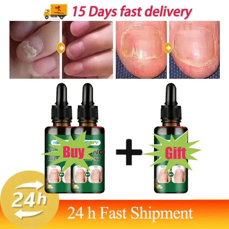 Nail Repairing Liquid Essence Hand Care Foot Fungal Removal Repair Serum Anti-infective Paronychia Nail Polish Repair Products
