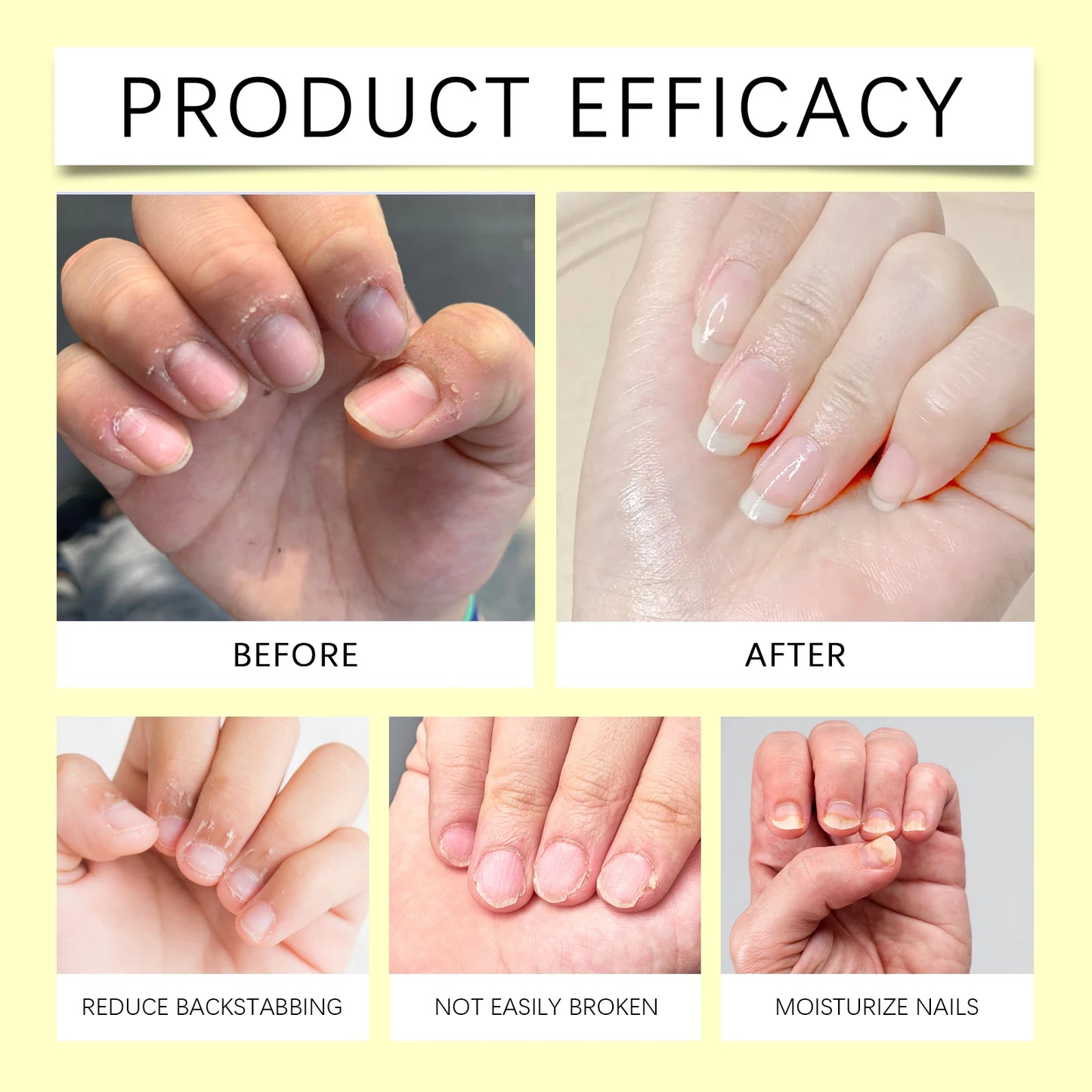 Nail Repair Serum Pen Cuticle Care Treatment for Brittle Nails Growth Strengthener Daily Nail Moisturizer Portable Kit with File