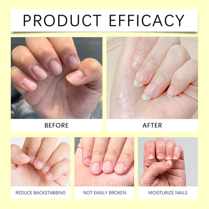 Nail Repair Serum Pen Cuticle Care Treatment for Brittle Nails Growth Strengthener Daily Nail Moisturizer Portable Kit with File