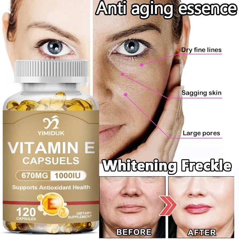 Buy 1 Get 1 Free! Vitamin E 670mg Capsules, Support Skin & Heart Health, Moisturizes from Within, Reduces Scars & Promotes Shine