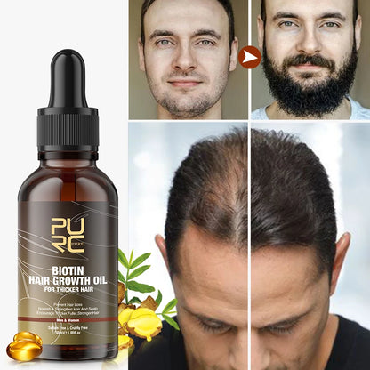 PURC Biotin Hair Growth Oil & Shampoo Conditioner Set Keratin Hair Treatment Smoothing Deep Repair Anti Hair Loss Hair Care