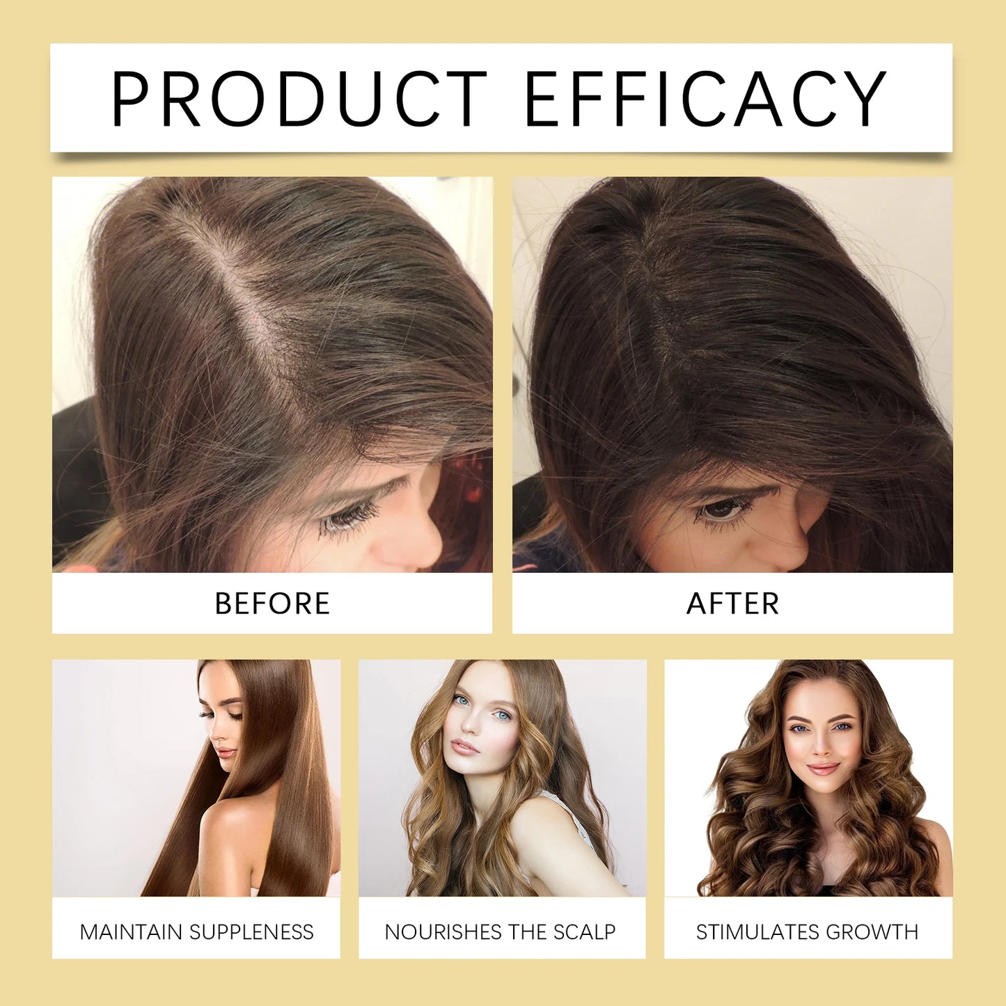 Scalp Nourishing Spray Strong Hair Nourishing Anti Hair Loss Scalp Care Refreshing Non Greasy Hair Plant Extract Care Fluid 30ml