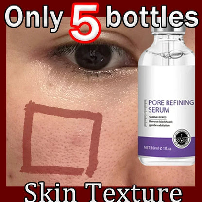 Skin Texture | Pore Refining Resurfacing, Brightening Facial Serum with Retinol and Niacinamide Non-Comedogenic