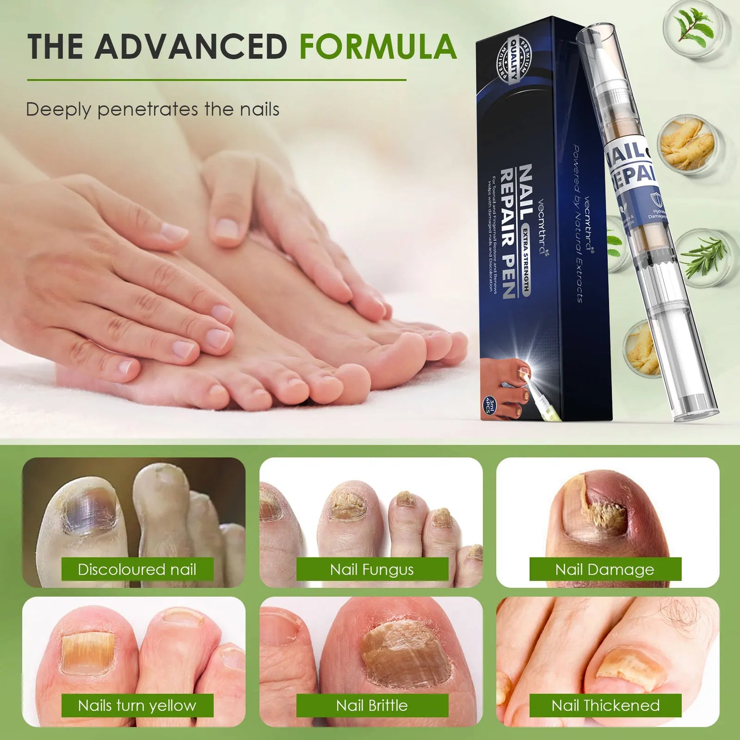 Nail Fungus Repair Essence Pen 3ml*4 Repair Fingernail 25%Undecylenic Acid Restores Appearance of Discolored Nail Foot Care Tool