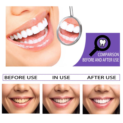 Teeth Whitening Toothpaste Remove Plaque Stains Cleaning Oral Hygiene Dental Bleach Corrector Tools Fresh Breath Beauty Care