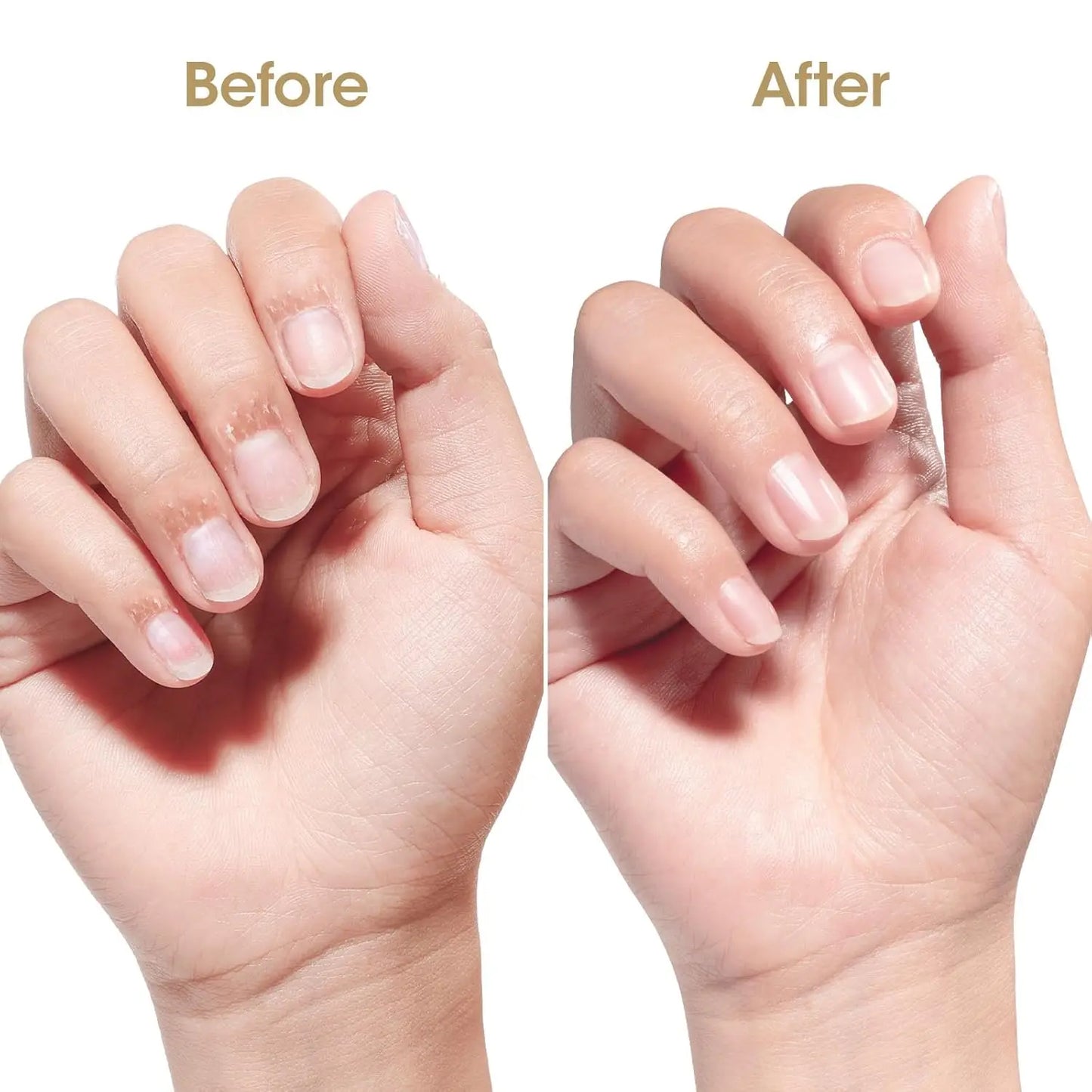 Keratin Vitamin E Nail Strengthening Serum Organic Cuticle Moisturizing Oil for Dry Fragile Nails Hydrating Manicure Supplies