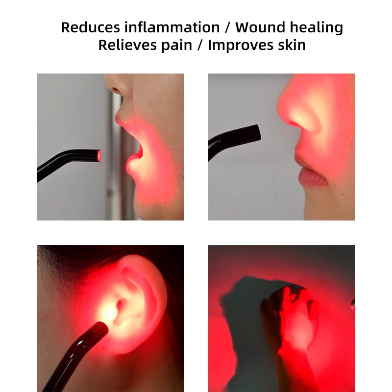 VV Dental Red Light Therapy Device or Cold Sore and Canker Sore For Pain Relief Handheld Removable LED Red Light