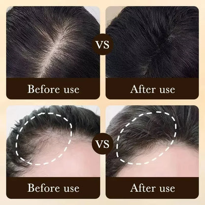 Hair Growth Treatment Strengthens Hair Nourishes Scalp Light Weight Non Greasy Improve Scalp Circulation
