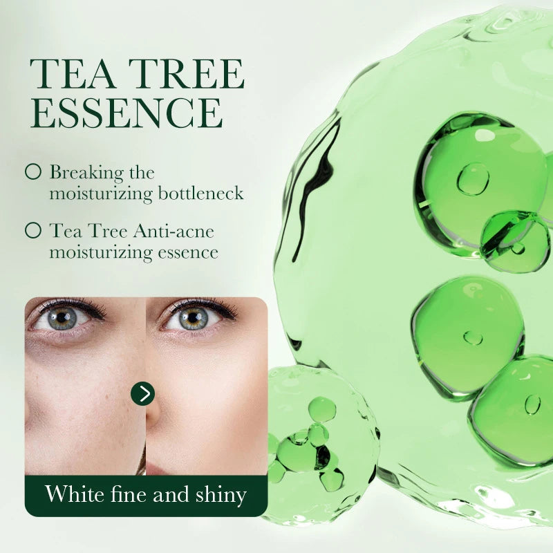 Tea Tree Acne Removing Cream Facial skincare Oil Control Face Gel Creams Hydrating Moisturizing Facial Cream Skin Care Set