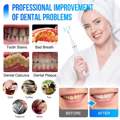 Electric Sonic Dental Calculus Scaler 5 Modes Oral Teeth Tartar Remover Plaque Stains Removal Teeth Cleaner Teeth Whitening Care