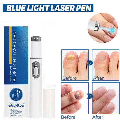 Nail Fungus Laser Pen Treatment Anti Fungus Infection Fungal Remove Dispel Onychomycosis Grow Foot Toe Fingernails Repair Care