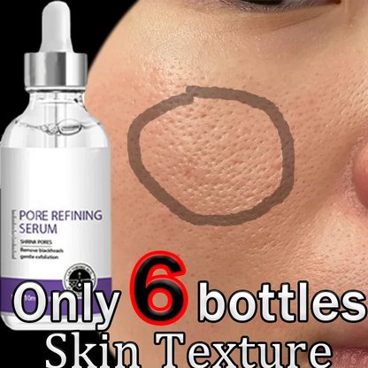 Skin Texture | Pore Refining Resurfacing, Brightening Facial Serum with Retinol and Niacinamide Non-Comedogenic