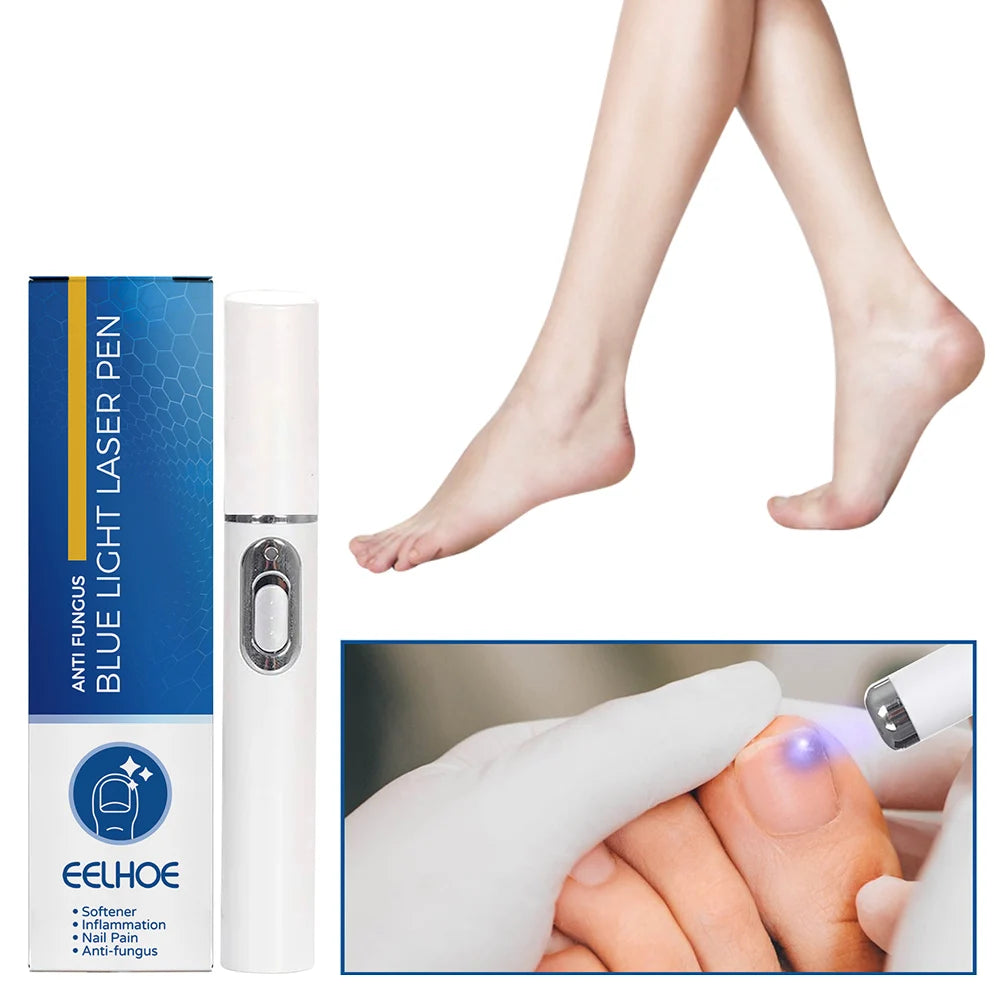 Nail Fungus Laser Pen Treatment Anti Fungus Infection Fungal Remove Dispel Onychomycosis Grow Foot Toe Fingernails Repair Care