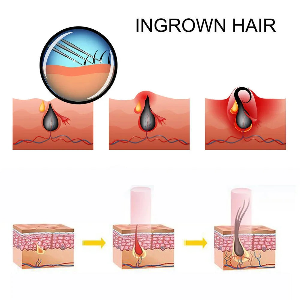 LED Red Light Therapy Massage Cap For Preventing Hair Loss Used For Professional Treatment Of Hair Loss Growth  Repair Of Dry