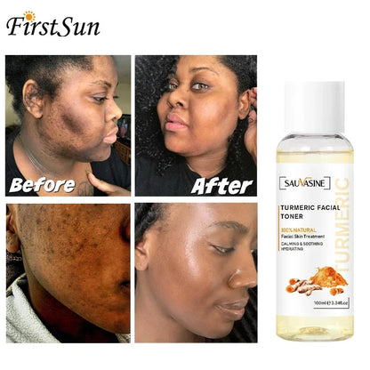 Turmeric lemon Skin Care products Acne Dark Spot Remover Whitening Brighten Facial Serum Face Cream Cleanser Serum Oil Cosmetics