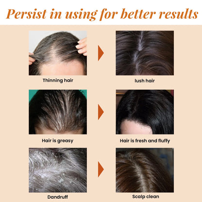 Hair Loss Treatment Fast Hair Growth Hair Anti Thinning Repair Scalp Strengthen Hair Roots Deep Cleansing Thickening Hair Care
