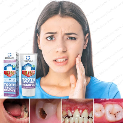 Healthy Teeth Remove Cavity Probiotics, 99% Repurchase