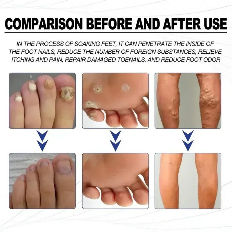 Foot Soaking Salts