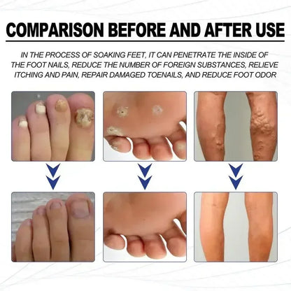 Foot Soaking Salts