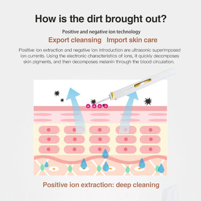 Xiaomi Ultrasonic Skin Scrubber Vibration Face Spatula Blackhead Remover Shovel Clean Cavitation Peeling Facial Lifting YOUPIN